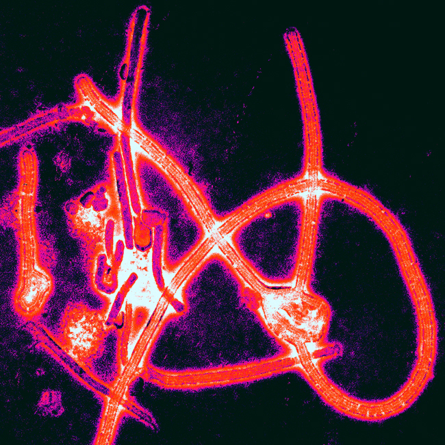 Ebola (Thomas W. Geisbert, Boston University School of Medicine)