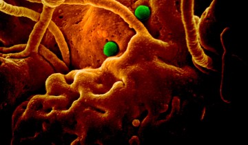 - MERS-CoV particles on camel epithelial cells